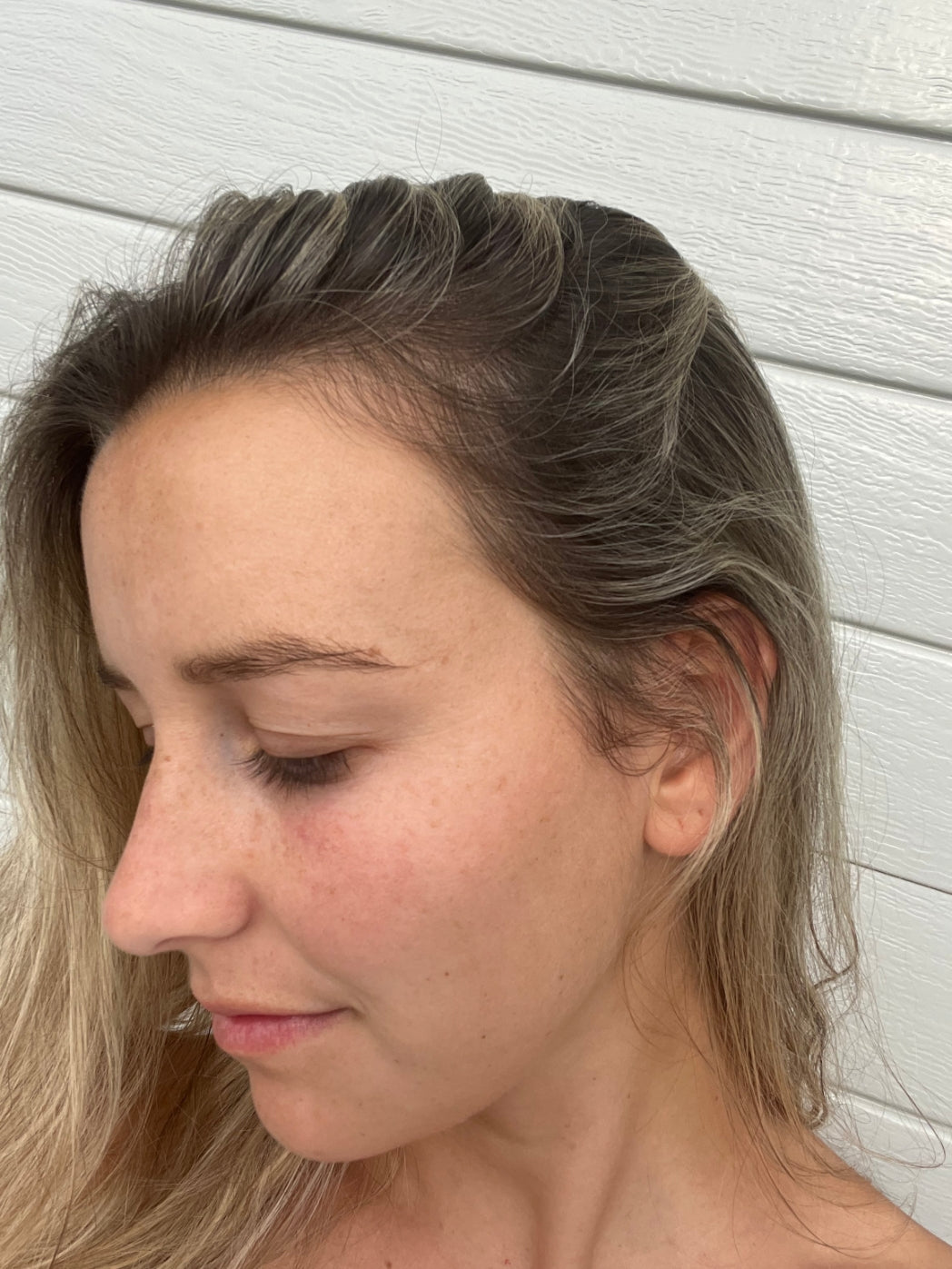 Derma Roller For Hair Growth